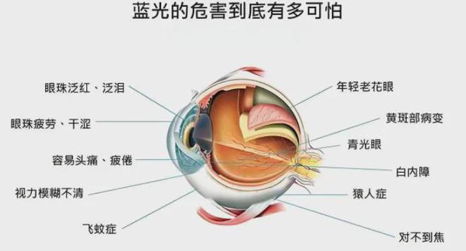 半岛(中国)体育·官方网站让孩子远离近视要做好这些！(图4)